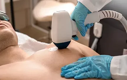 Depilacja brodawek sutkowych
